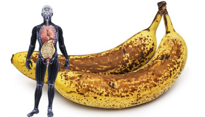cura-platano