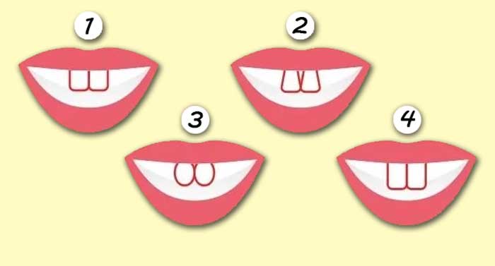 La forma de tus dientes revela cosas muy interesantes de tu personalidad. ¡Elige la tuya!